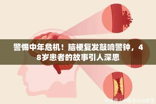 警惕中年危机!脑梗复发敲响警钟,48岁患者的故事引人深思
